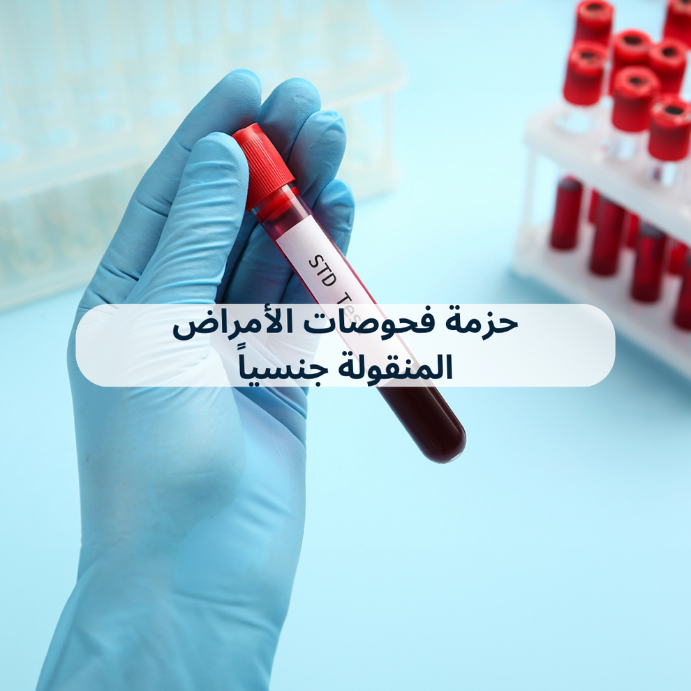 SEXUALLY TRANSMITTED DISEASES (STDs) – Biolab Wellness Store