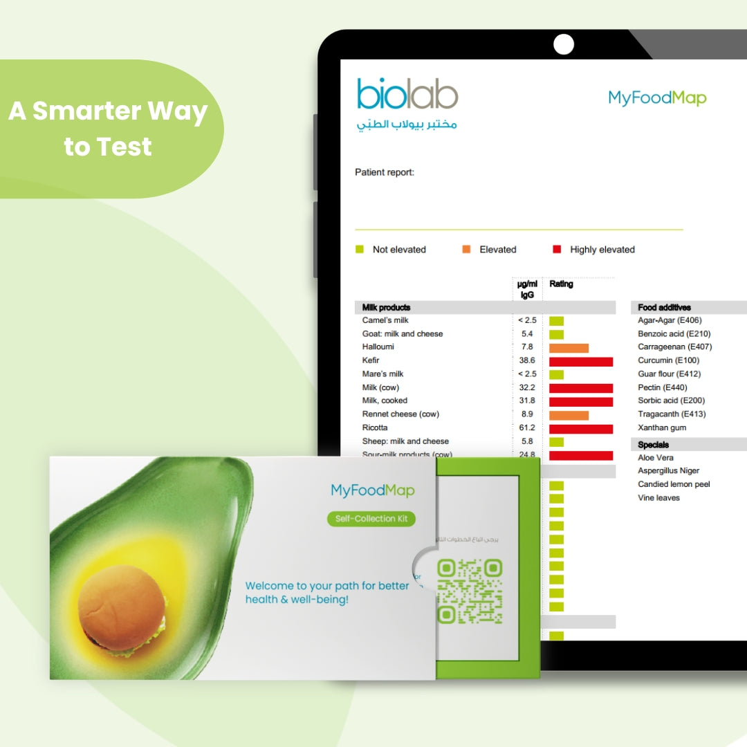 فحص البصمة الغذائية