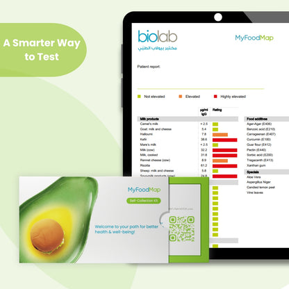 فحص البصمة الغذائية